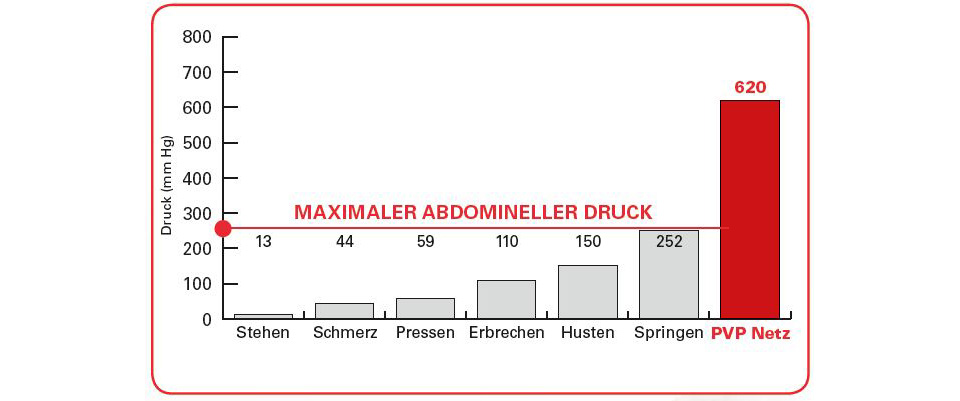 Nabelbruch